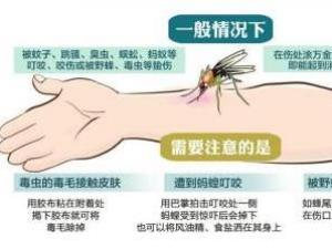 被毒蚊子咬了怎么辦？蚊子咬了怎么消腫止癢