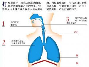 打嗝不止怎么辦？打嗝偏方