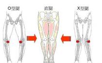 5種走路姿勢(shì)會(huì)讓你變成O型腿