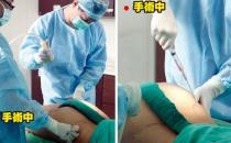 女性吸脂瘦腰有哪些疑問